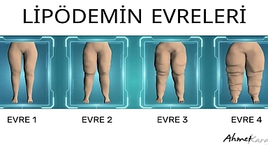 PROF. DR. AHMET KARACALAR UYARDI: BU BİR OBEZİTE DEĞİL, İLKEL ÇAĞLARDAN KALAN 'EVRİMSEL' BİR MİRAS